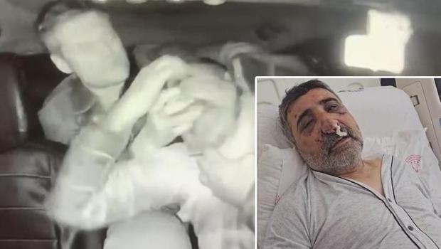 İngiliz boksörün darbettiği taksici konuştu: Ellerini gözüme sokmaya çalıştı, ısırmaya, öpmeye başladı