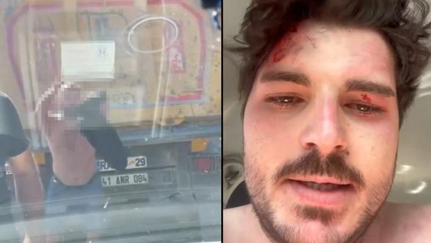 Oyuncu Akdeniz, 4 kişi tarafından trafikte darbedildi! 'Öldürene kadar döveceklerdi'