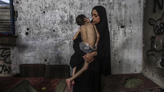 Gazze'de açlık krizi büyüyor: Ölenlerin sayısı 127'ye yükseldi