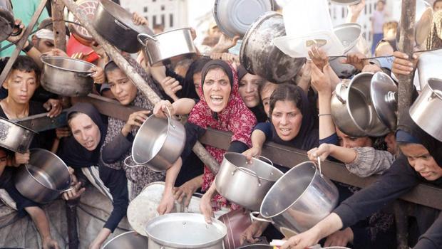 Gazzeli doktor anlatıyor… Çocuklar ‘bir deri bir kemik’ kaldı