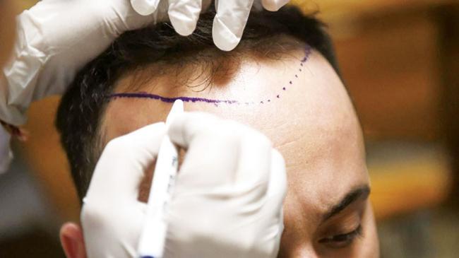 Ortadoğulunun saçını ektik sıra Batı’da | Ekonomi Haberleri