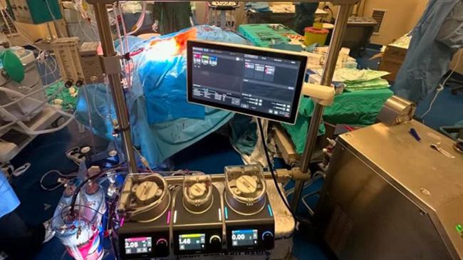 TÜSEB ve ASELSAN'dan işbirliği... Yerli ve milli kalp-akciğer makinesi tanıtıldı | Genel Haberler