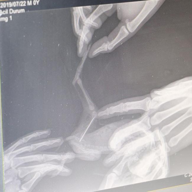 Platinum plate inserted in baby rabbit’s leg injured in flood