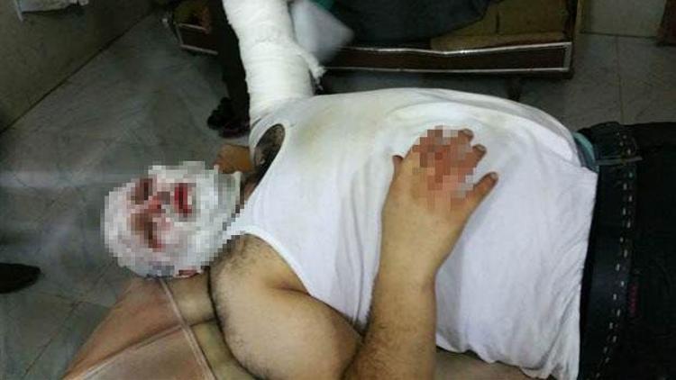 AA muhabiri Suriyedeki füze saldırısında yaralandı