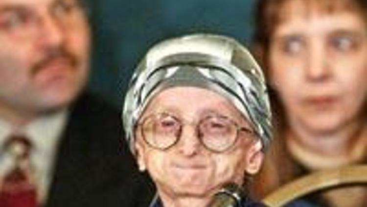 Türkiye’den progeria hastası çocuk aranıyor