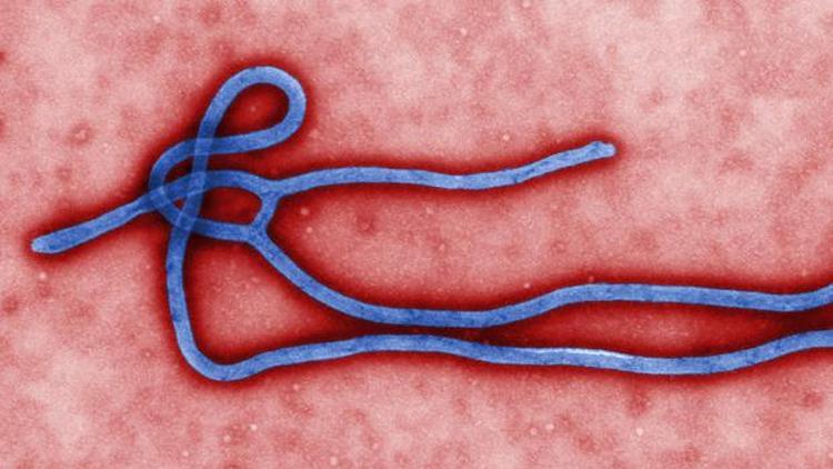 Ebolaya yakalanan İskoç hemşirenin durumu kritik