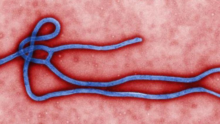 İskoçya’da Ebola virüsü tespit edildi