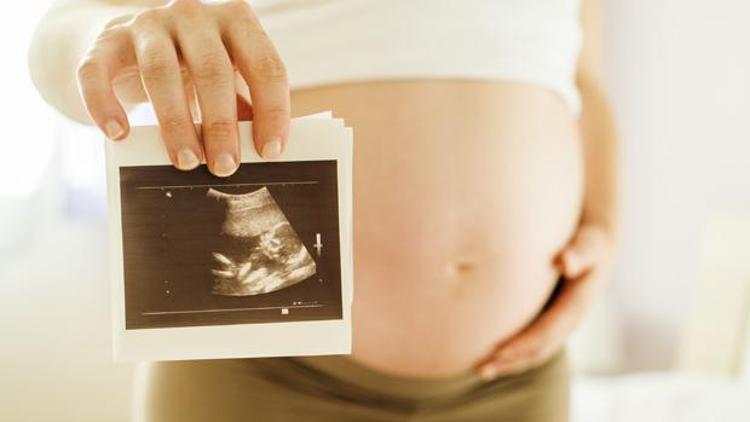 Hamilelikte ultrason zararlıdır açıklamasına sert tepki