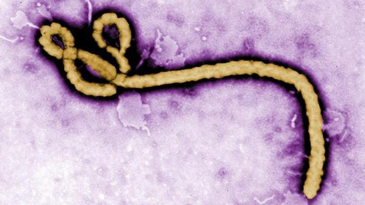 ABDde Ebola virüsü çıktı, ilaç şirketlerinin hisseleri patladı