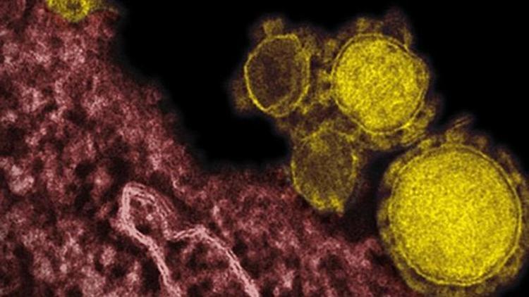 Türkiyede MERS virüsünden ölüm