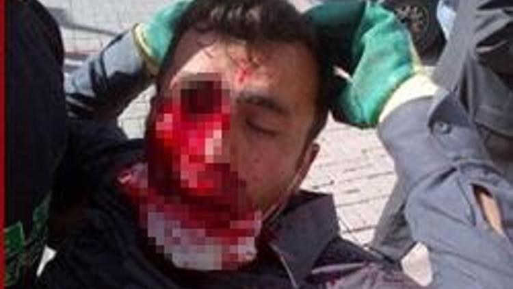 Ankarada vurulan belediye işçisi gözünü kaybetti