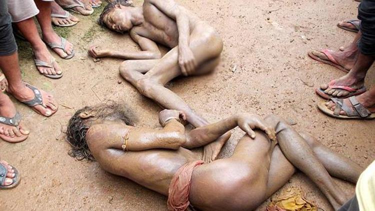Hindistanda köylüler, tecavüzle suçladıkları kişileri bu hale getirdi