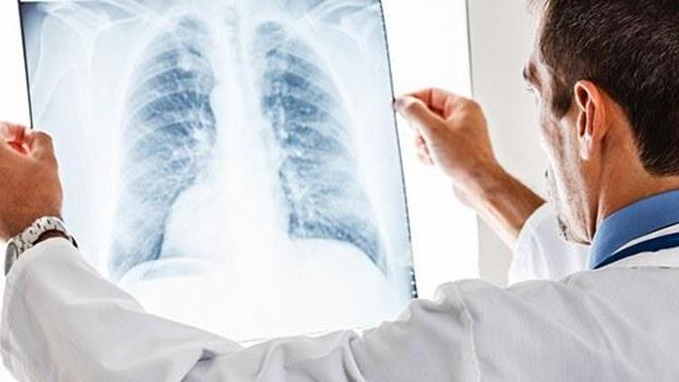 Akciğer hastalıklarına karşı mide bakterisi umudu
