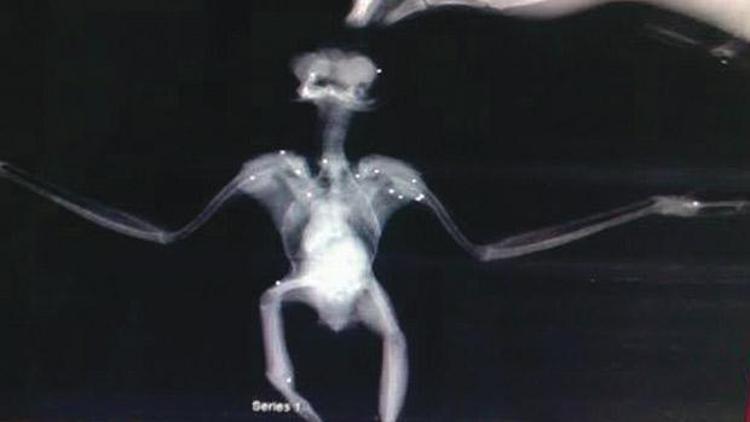 Kırık kanat röntgeni