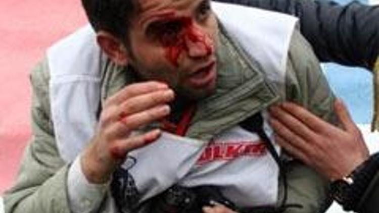 Diyarbakır-Bursa maçında taşlardan bir gazeteci yaralandı