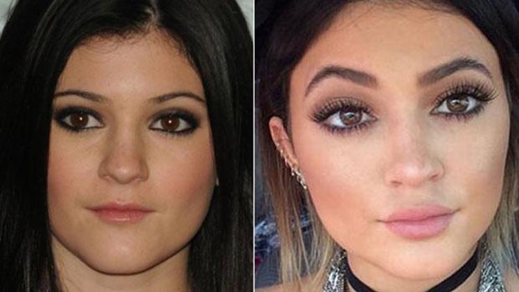 Kylie Jennerın dudakları sosyal medyada alay konusu oldu