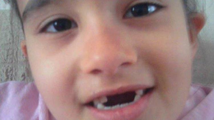 Çocuğunun kalıcı dişlerinin çekildiğini söyleyen baba şikayetçi