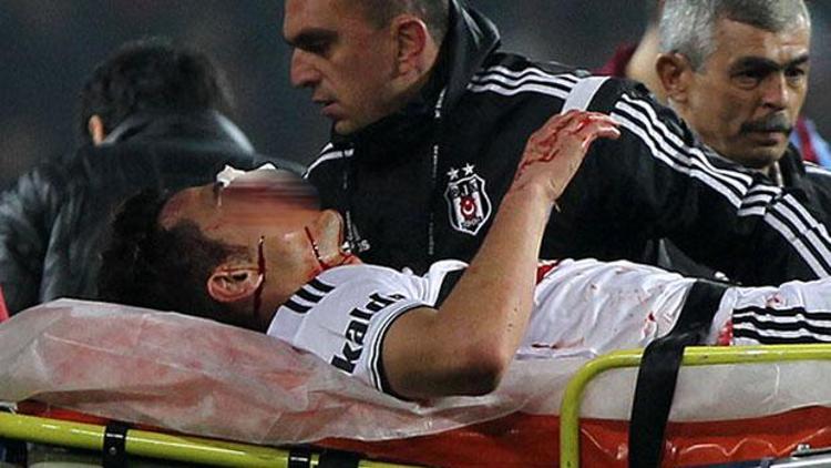 Beşiktaşta şok Mustafa Pektemekin burnunda ve yüzünde kırıklar var