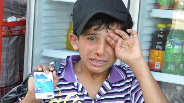 Suriyeli çocuğa esnaftan dayak