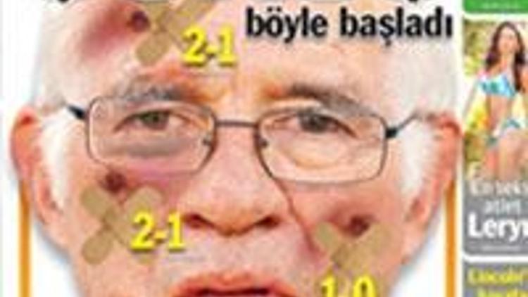 Aragones ile Ziconun 5 farkı