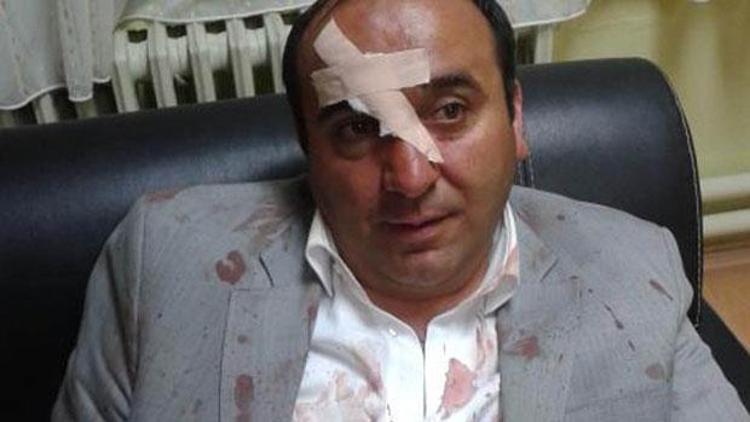 AK Partili Belediye Başkanı saldırıya uğradı
