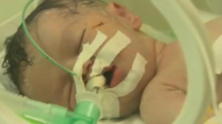 Filistinli bebek Şeymadan kötü haber geldi