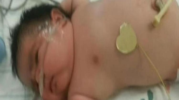 6.2 kilogram doğan bebek görenleri şaşırttı