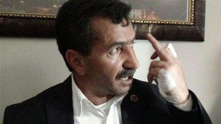 AK Partili Belediye Başkanı Ömer Vargün saldırıya uğradı