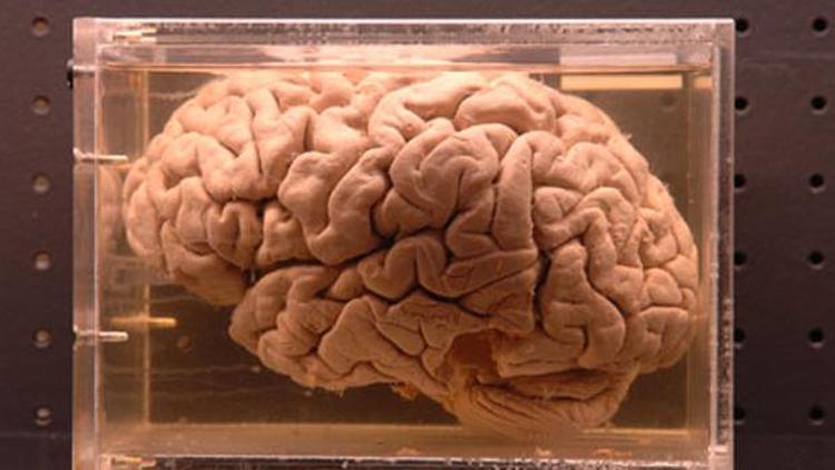 ABDde bir üniversitedeki 100 beyin çalındı