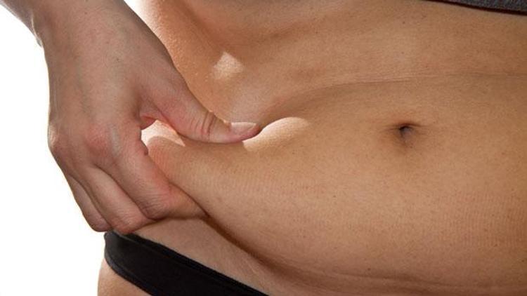 Polikistik over sendromlu kadınlarda obezite daha yaygın