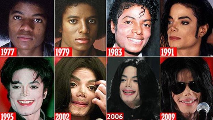 İşte Michael Jacksonın estetik hikâyesi