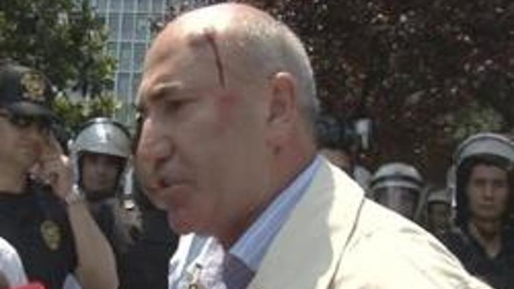 CHPli vekil Tanal kentsel dönüşüm eyleminde başından yaralandı