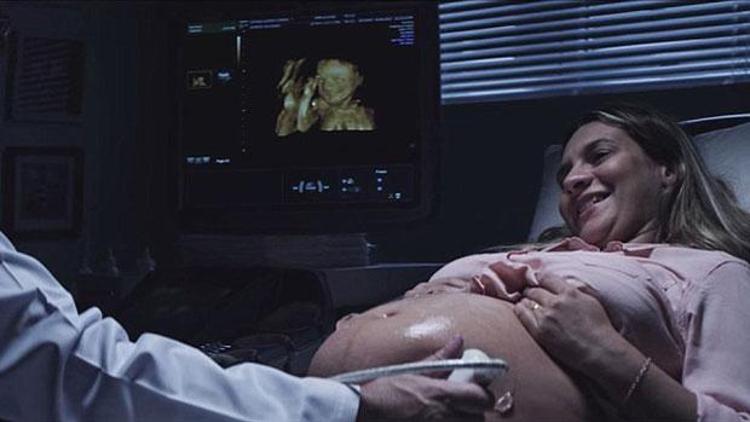 Görme engelli anne adayına 3D yazıcılı ultrason sürprizi
