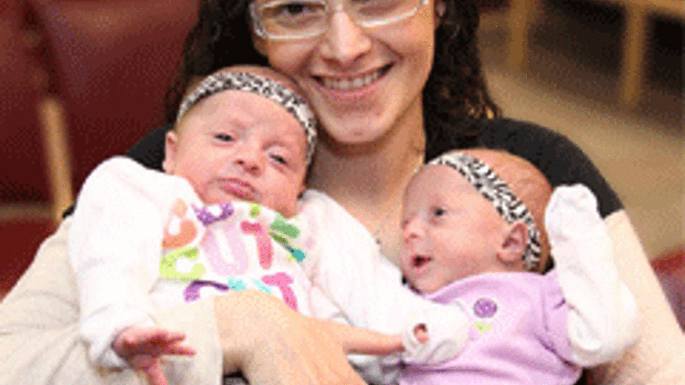 Kalp nakli yapılmış kadın ikiz doğurdu