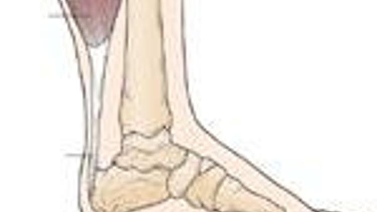 Aşil tendonu yaralanması