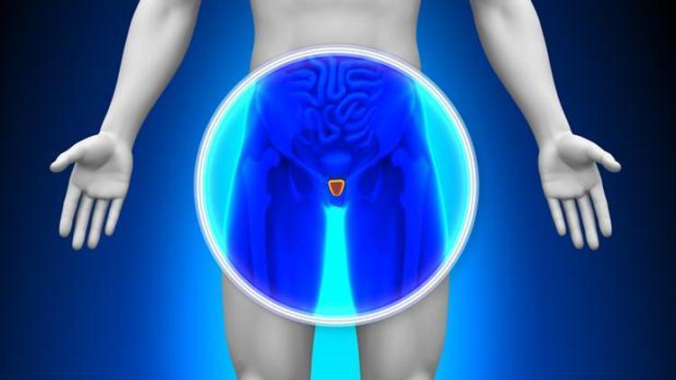 Erkekler prostat kanseri taramasından kaçıyor