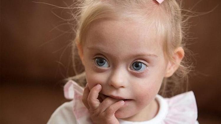Down sendromlu 2 yaşındaki kız reklamların aranan yüzü oldu