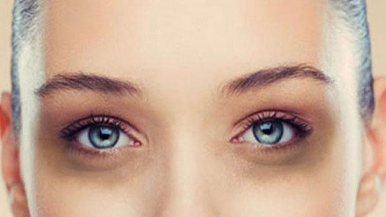 Göz altı morluklarından kurtulma yöntemleri nelerdir