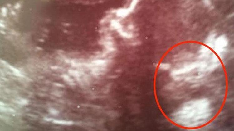 Bebeğine ultrasonda gördüğü film karakterinin adını verdi