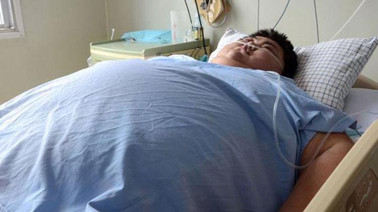 Üç yılda 150 kilo alan Çinli öldü