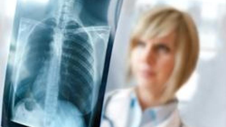 Akciğer kanseri teşhisinde röntgene dikkat