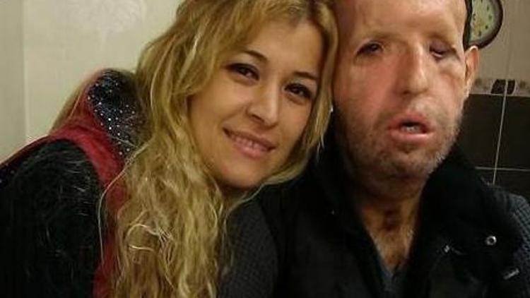 Türkiyenin beşinci yüz nakli hastası Recep Sertin eşi isyan etti