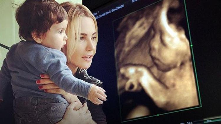 Ece Erken oğlu Eymenin ultrason fotoğrafını paylaşınca olay oldu