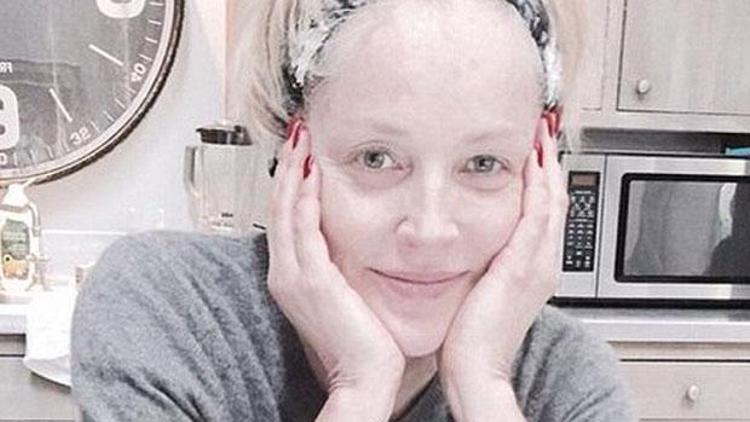 Sharon Stoneun yüzüne ne oldu