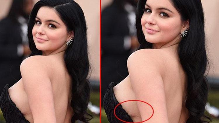 Ariel Winter, meme küçültme ameliyatının izlerini gösterdi