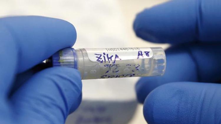 Brezilyalı bilim adamları Zika virüsünün DNA dizilimini keşfetti