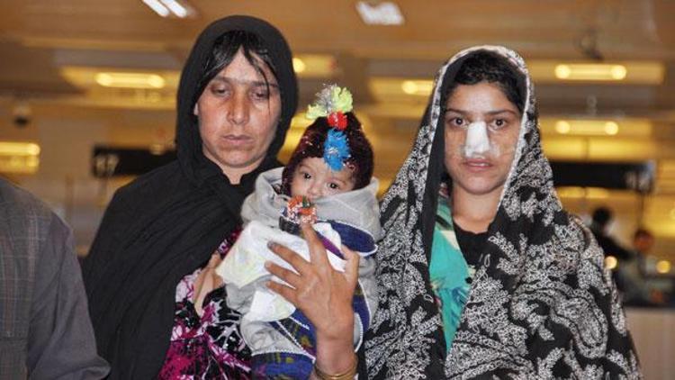 Burnu kesilen Afgan kadın tedavi için Türkiyede