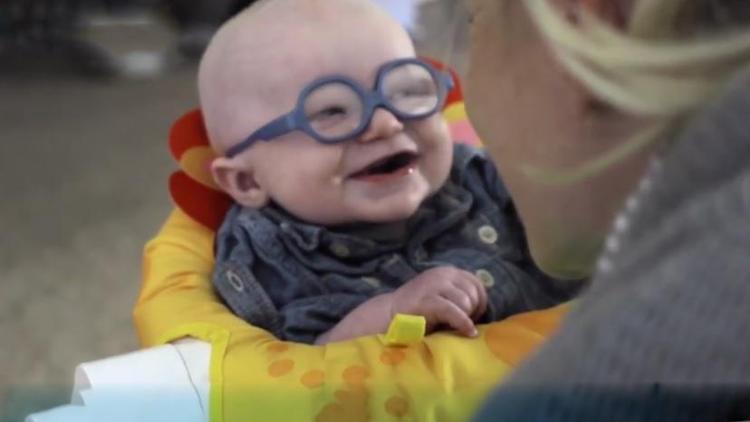 Albino hastası bebek annesini ilk defa görünce...