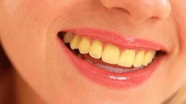 Dişlerimiz neden sararır