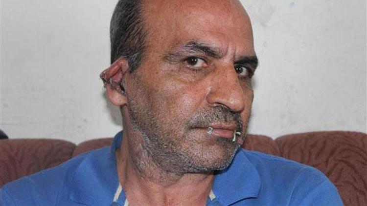 İranlı sığınmacı ağzını ve kulaklarını dikti